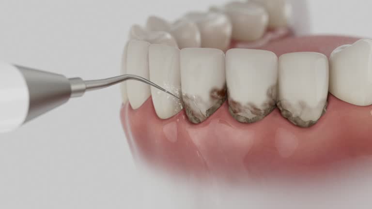 Reliable Dental Implants contractor in Keystone Heights, FL by Smile Center Dentistry
